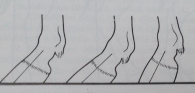 k5